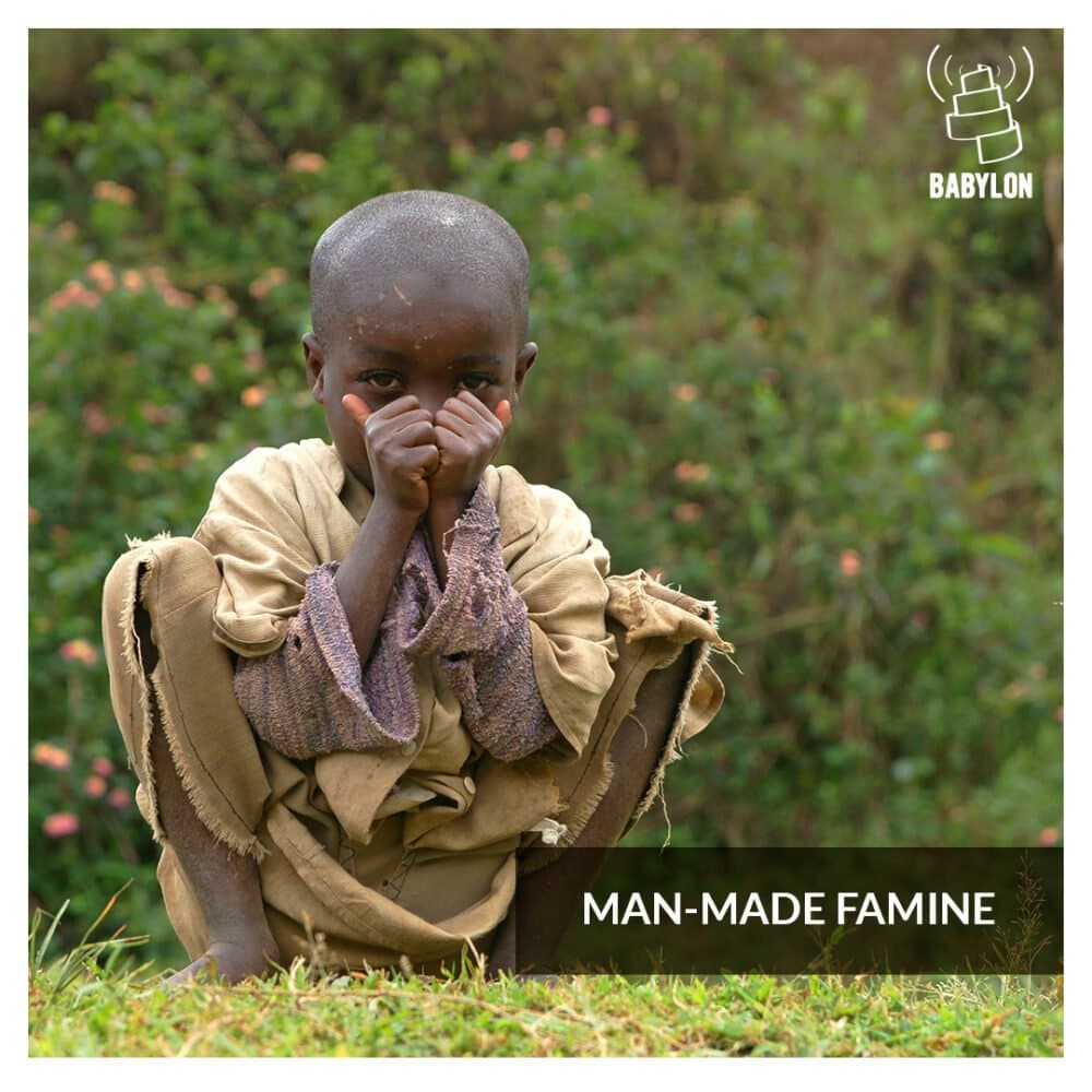 Man-made famine: the horrific weapon killing 12 million children in Yemen