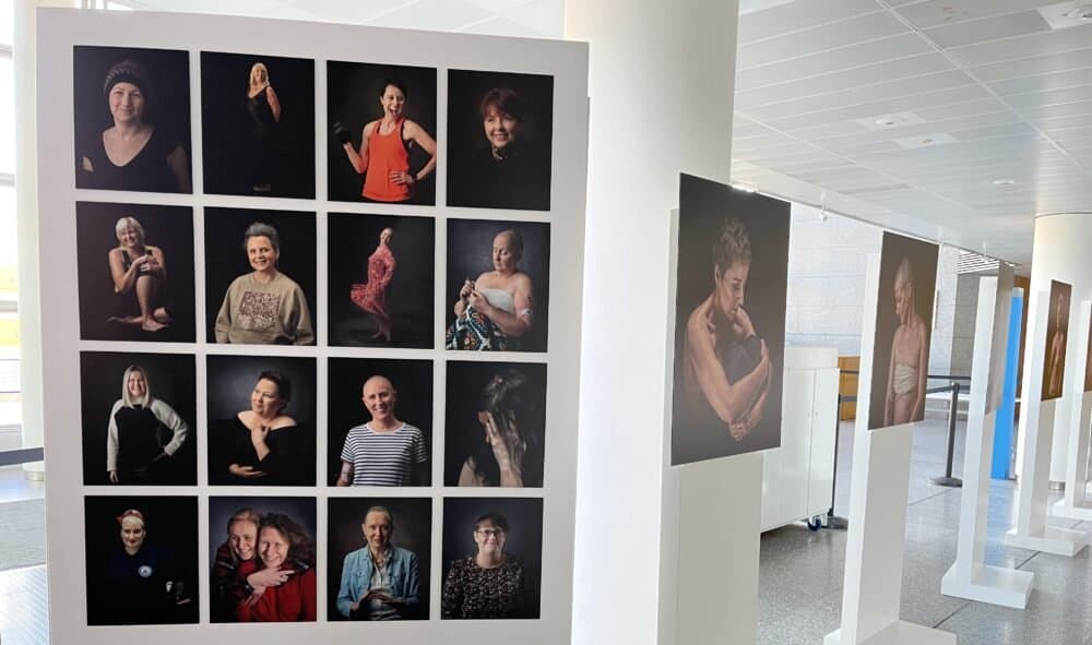 ‘Seen to be Heard’ reveals secondary breast cancer realities